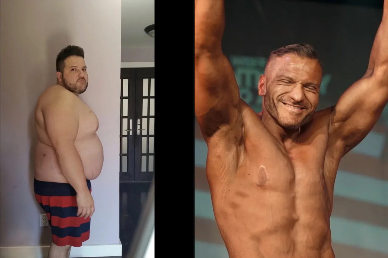 Anthony Lolli at 305 pounds, and on stage after losing 124 pounds